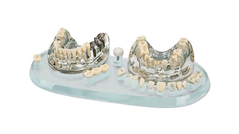 Demonstracijski model Implant C+B