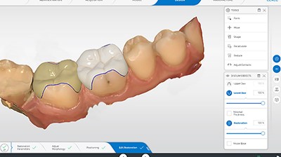 CEREC Software